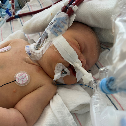 Baby Pierce in the NICU at St. Christopher's Hospital for Children