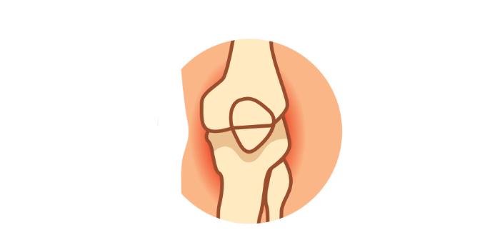 Number 11: Joint Pain - Excess weight can strain joints, causing pain and stiffness.