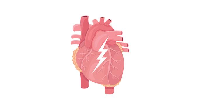 Number 2: Heart Disease and Heart Attack: Obesity can cause high blood pressure, cholesterol, and blood sugar, which can harden arteries and cause heart disease, increasing the risk of heart attack.