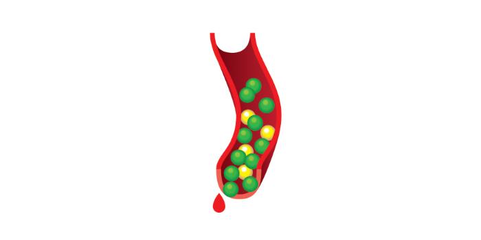 Number 3: Type 2 Diabetes - The body becomes resistant to insulin, leading to high blood sugar and increasing the risk of Type 2 diabetes.