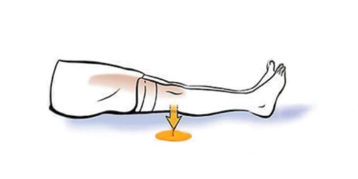 A person's leg is outstretched. Knee presses into bed while tightening the muscles on the front of the thigh.